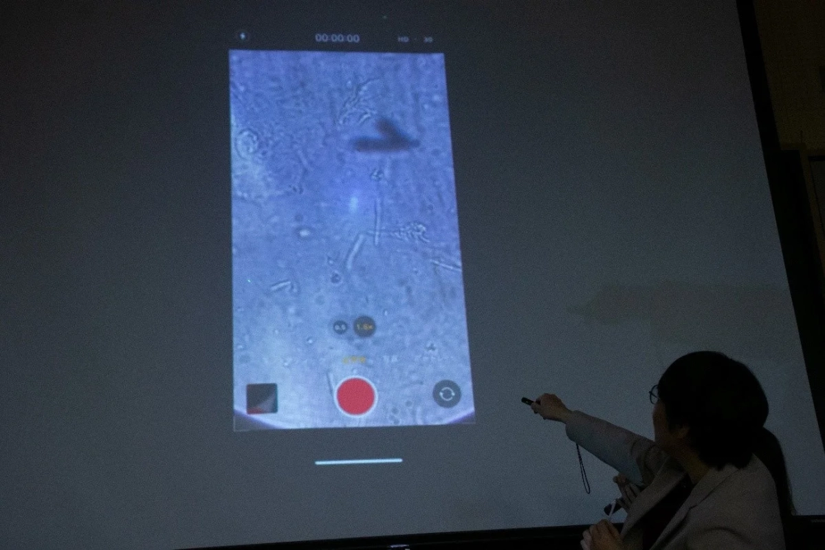 顕微鏡画像が投影されたスクリーン