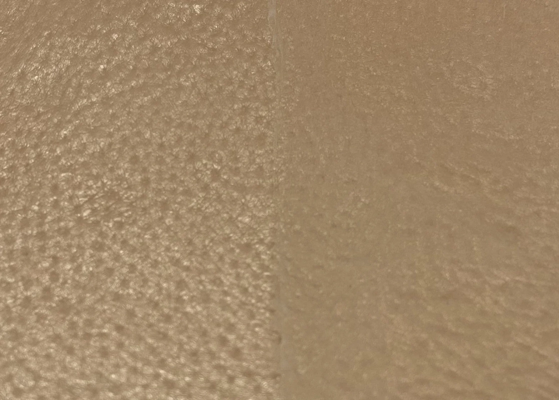 肌のクローズアップ画像