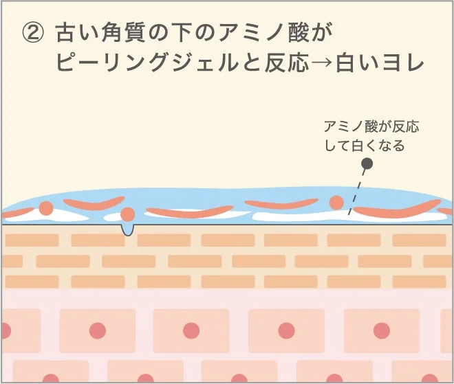 古い角質の下のアミノ酸がピーリングジェルと反応→白いヨレ